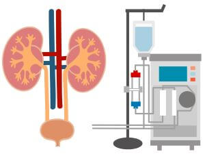 腎疾患　人工透析